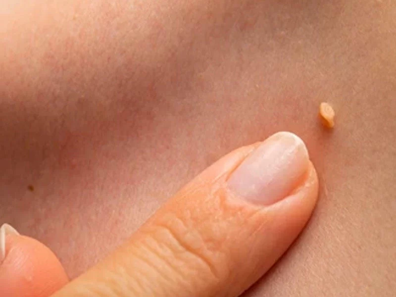 Ayollar qamoqxonasida yalangoch ayollar